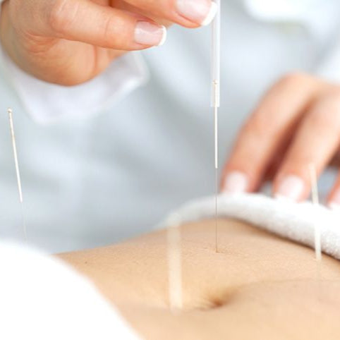 Acupuntura para el Síndrome del Intestino Irritable y Trastornos Digestivos