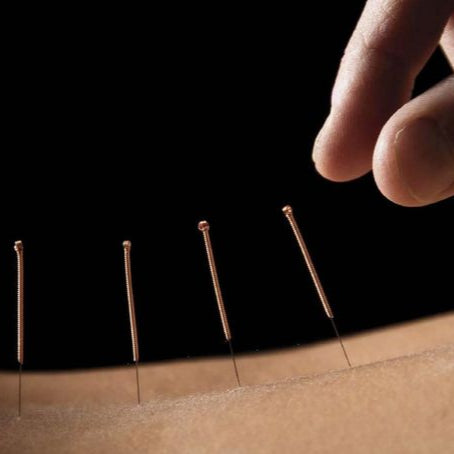 Acupuntura para Alergias y Rinitis Alérgica