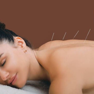 Acupuntura para la Ansiedad y el Estrés